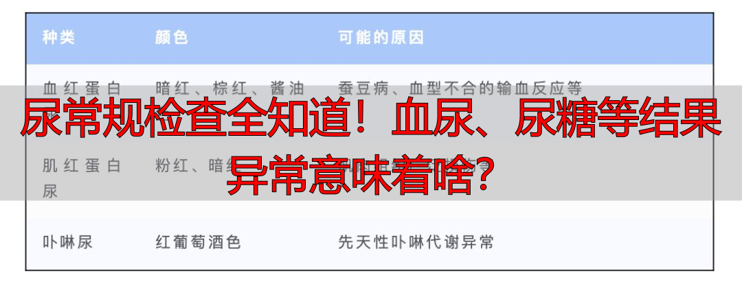 尿常规检查全知道！血尿、尿糖等结果异常意味着啥？