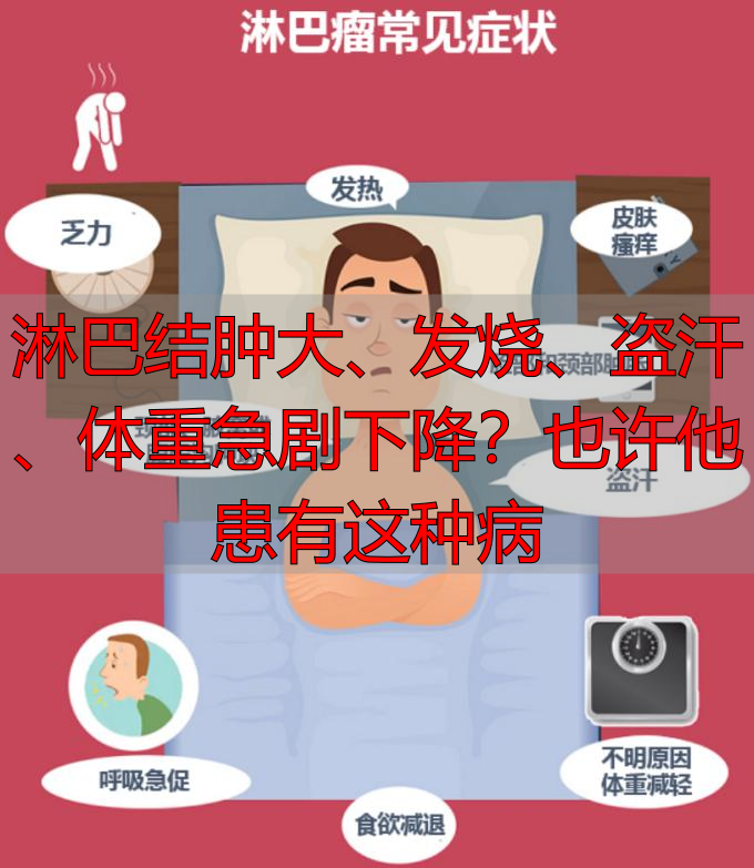 淋巴结肿大、发烧、盗汗、体重急剧下降？也许他患有这种病