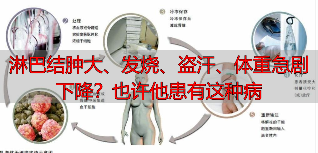 淋巴结肿大、发烧、盗汗、体重急剧下降？也许他患有这种病