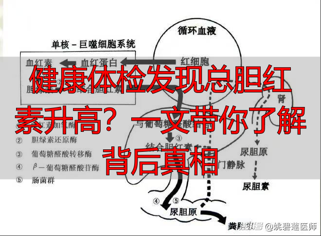 健康体检发现总胆红素升高?一文带你了解背后真相