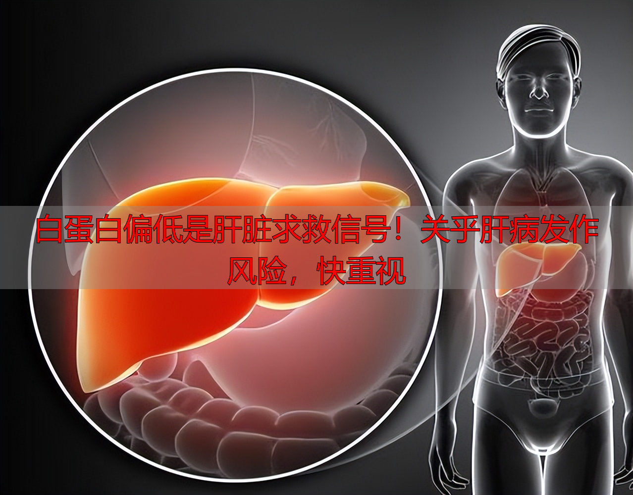 白蛋白偏低是肝脏求救信号！关乎肝病发作风险，快重视